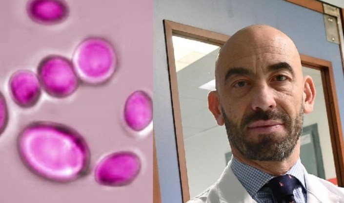 Candida auris, un caso originario della Spezia. Bassetti: colpisce in ospedale