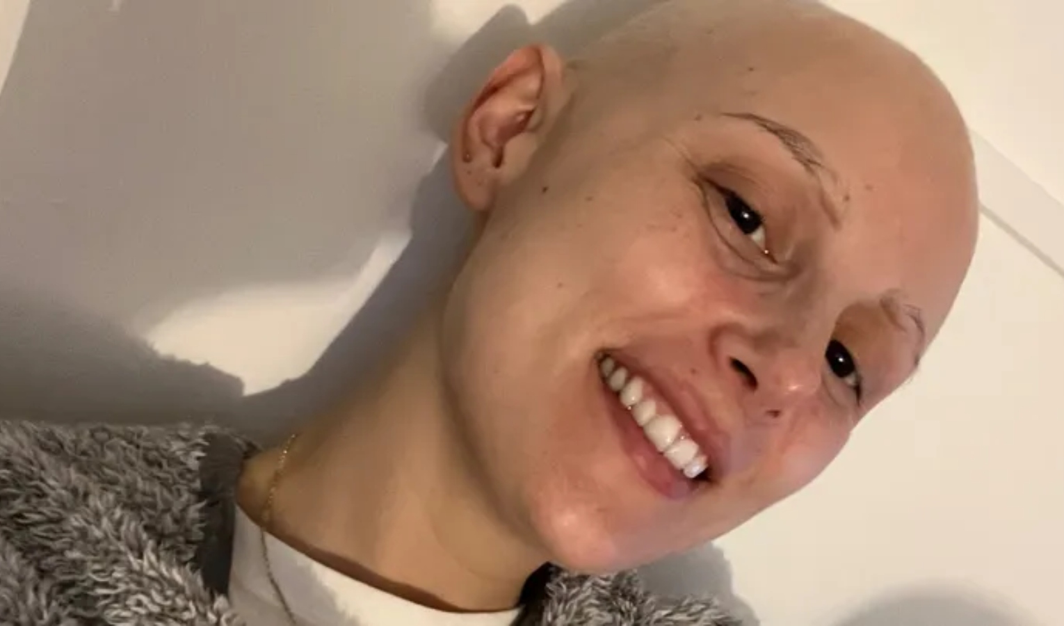 Ragazza sorridente senza capelli