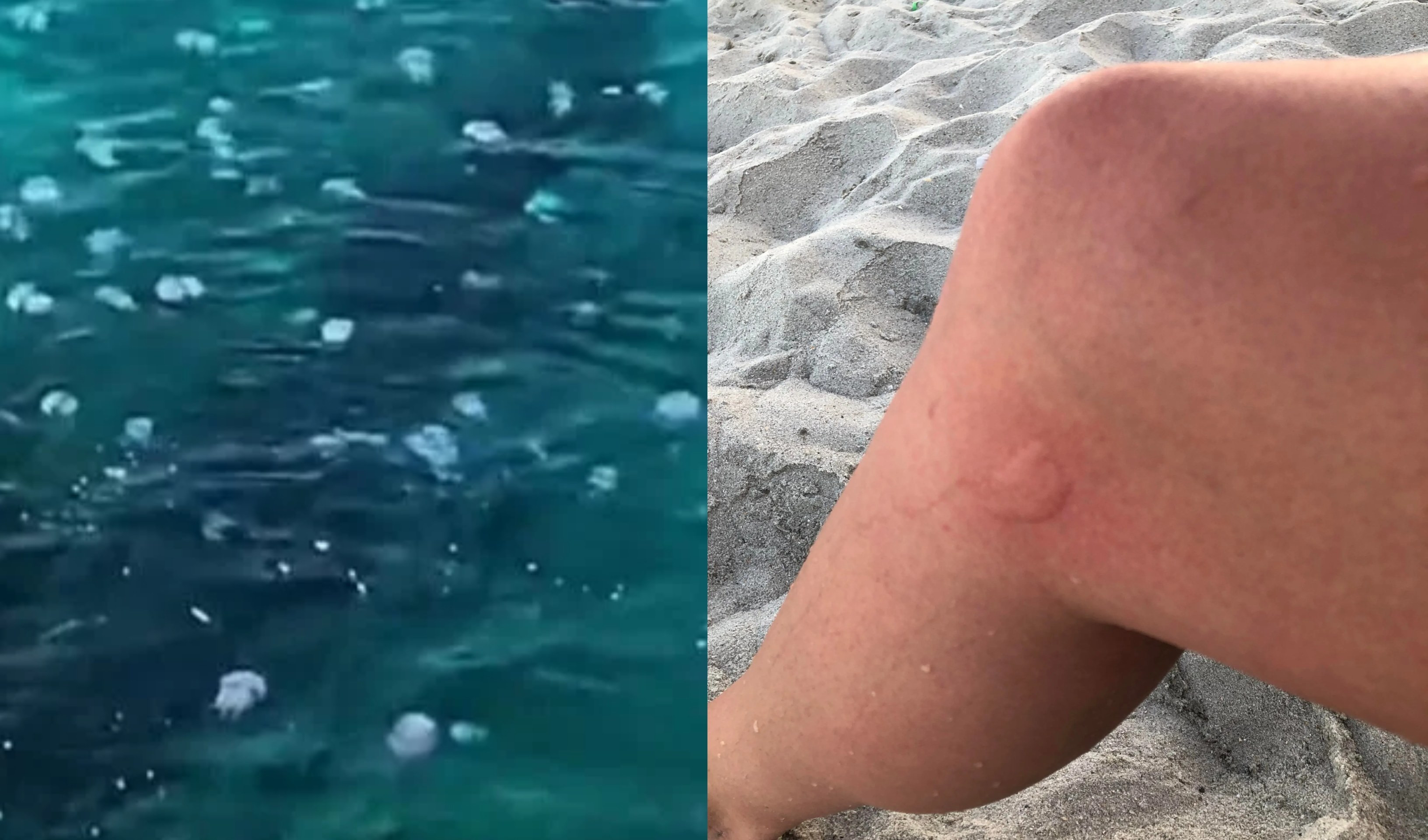 Distese di meduse in Liguria, ma non solo pericolose: 