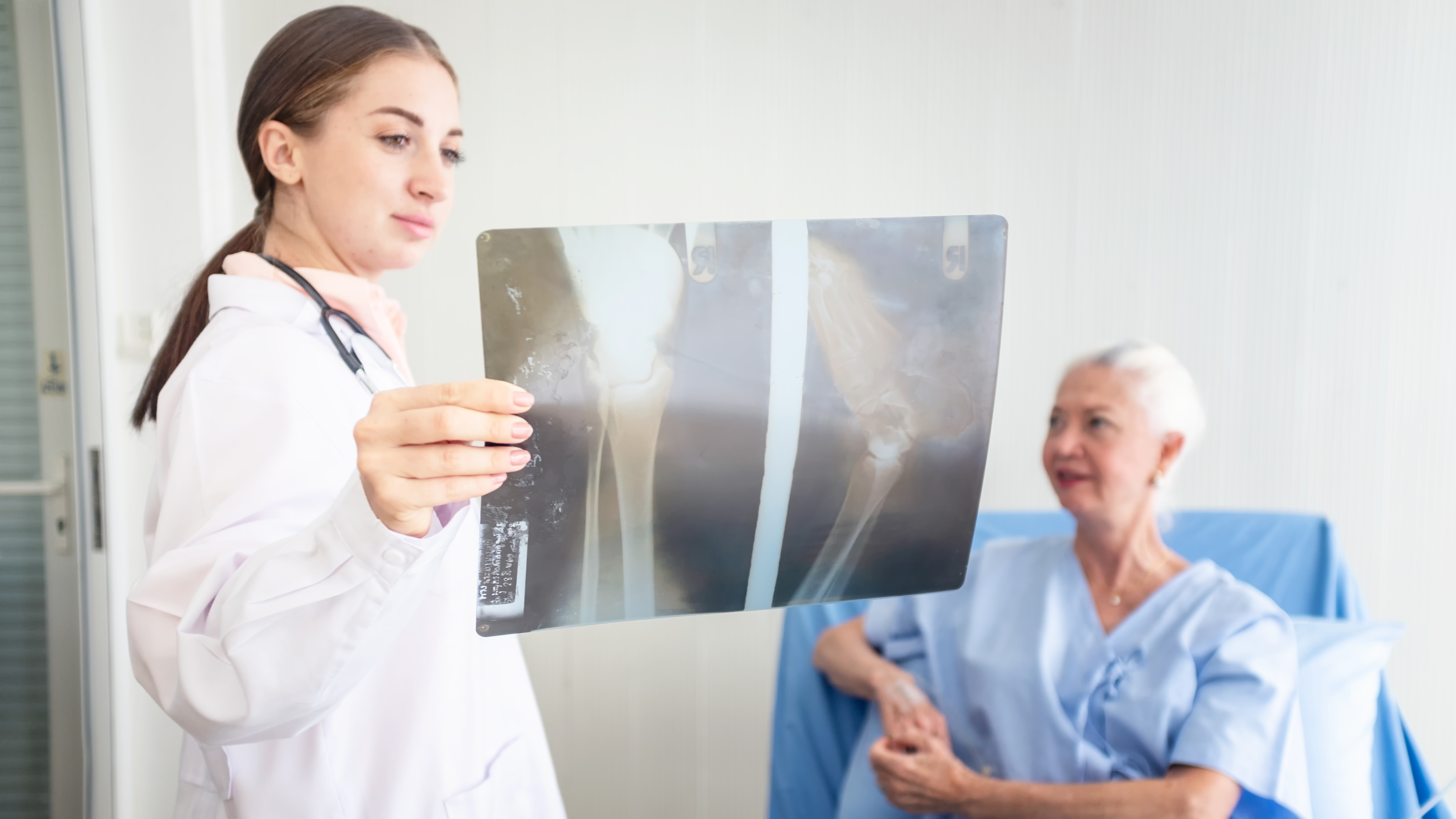 In Liguria 4500 fratture di femore per osteoporosi, costo di 50 milioni di euro