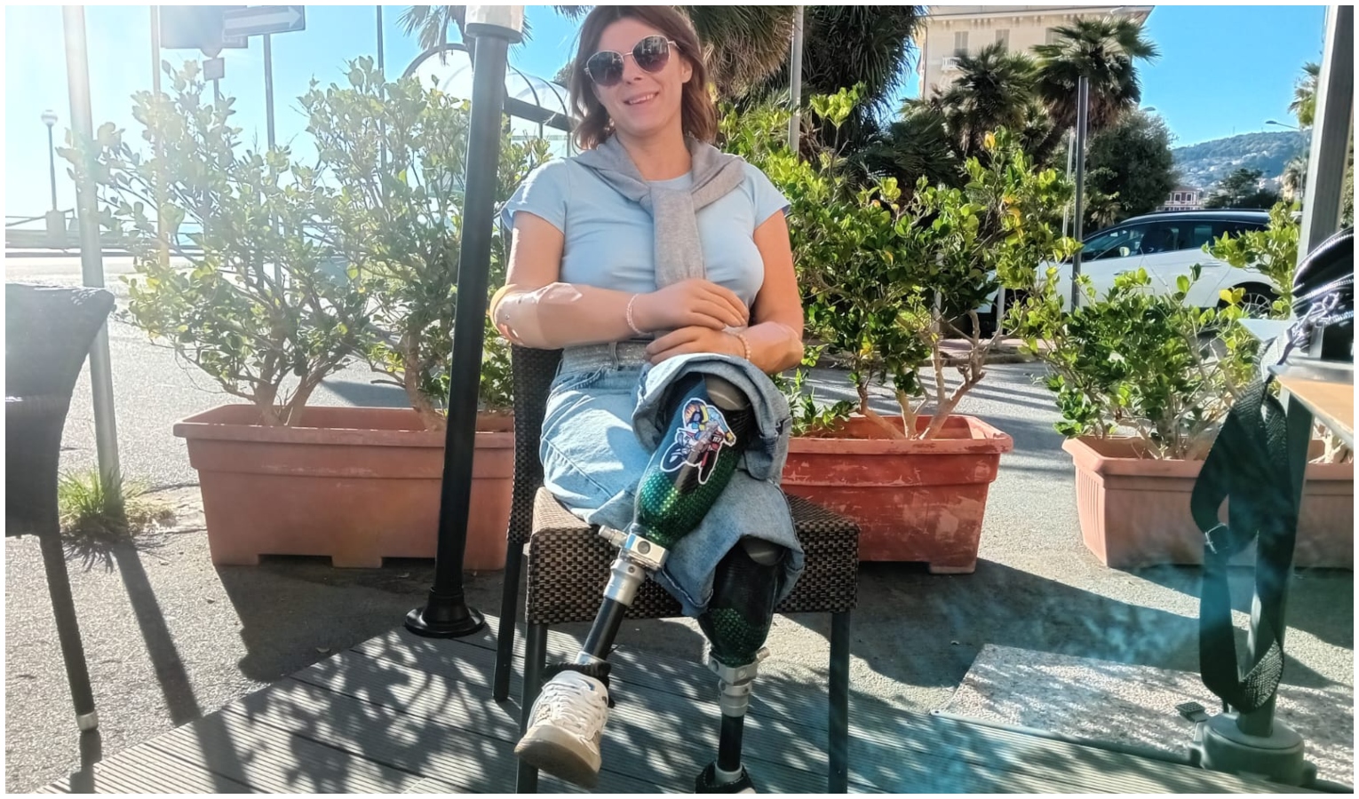 Giada Ottonello con le quattro protesi