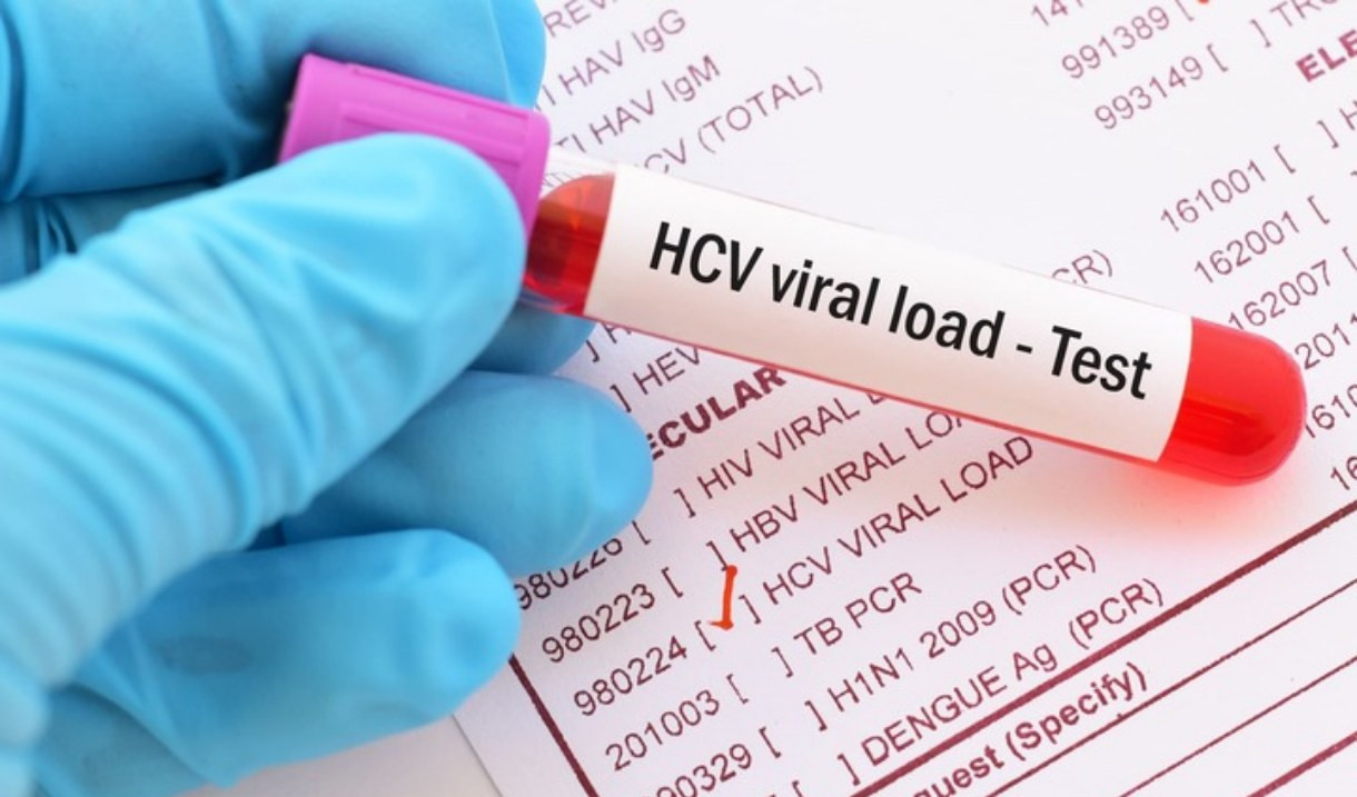 Giornata dell'epatite, in Liguria screening gratuito per eliminare il virus hcv