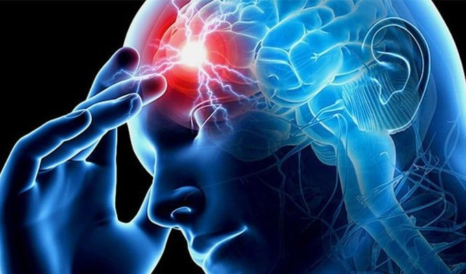 Ictus, il neurologo: con il caldo i rischi non aumentano