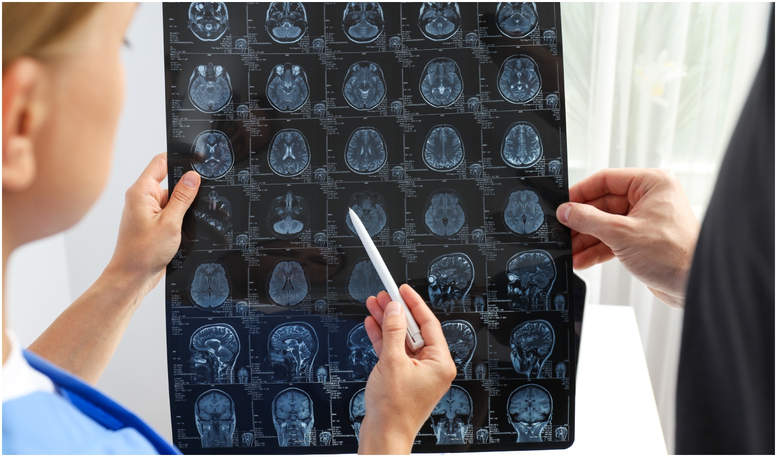 Medico donna guarda una risonanza