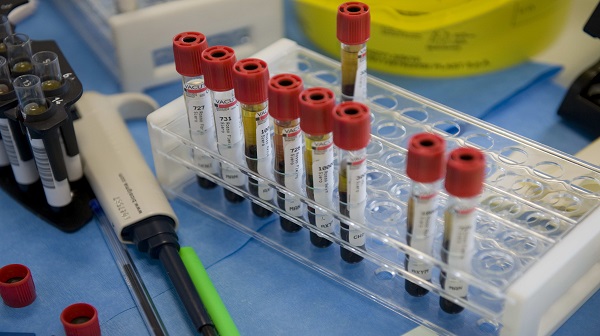 Nuovo caso di meningite in Liguria, bimbo di 5 anni ricoverato al gaslini 