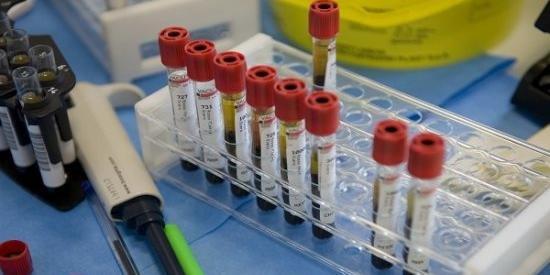 Meningite a Genova, 36enne muore dopo il ricovero