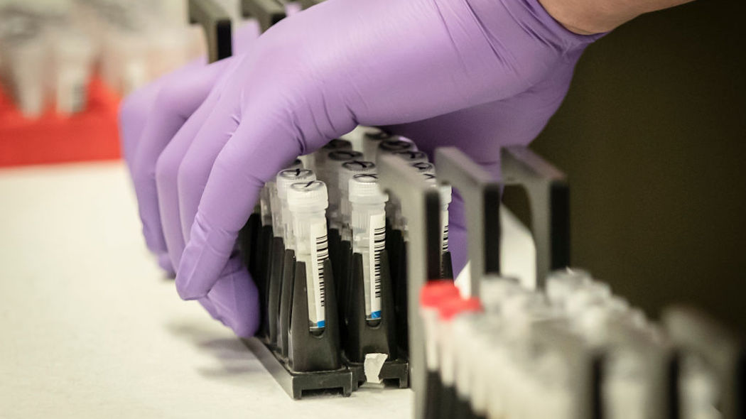 Coronavirus, a Genova il primo guarito con il farmaco sperimentale Remdesivir