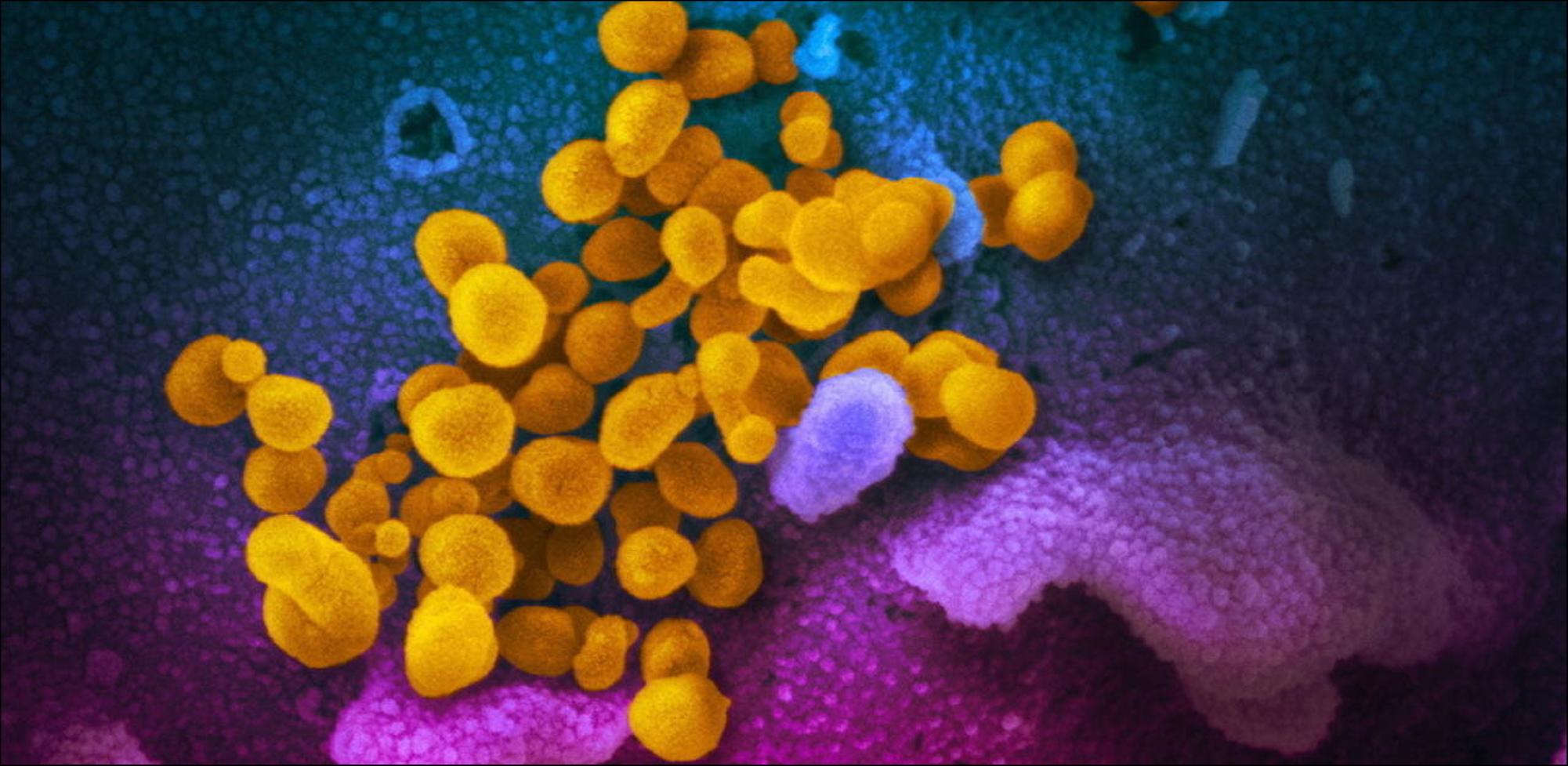 Arrivati in Liguria i primi flaconi di anticorpi monoclonali per combattere il Covid